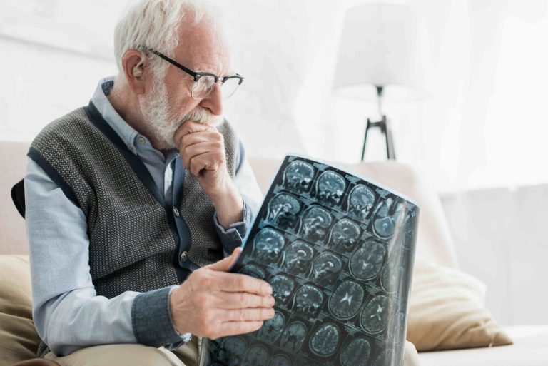 Risk factors for faster aging in the brain revealed in new study