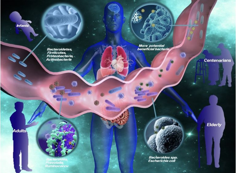 Aging Gut Microbiome in Healthy and Unhealthy Aging