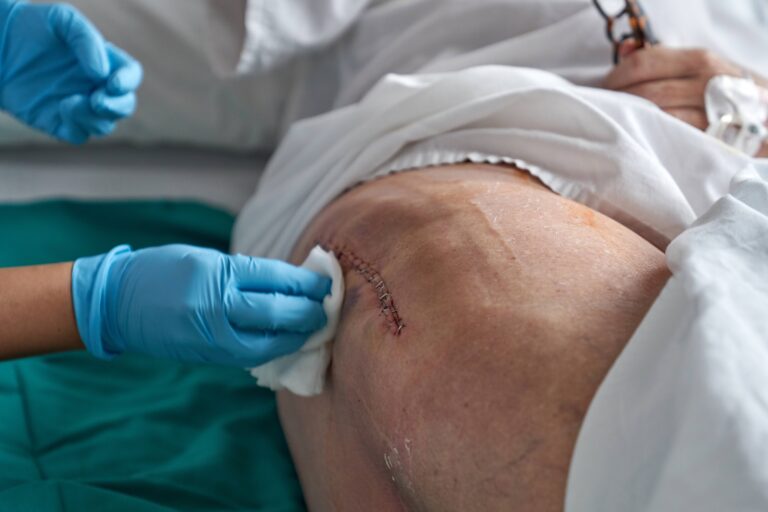NeoGEN Electric Cell Signaling Mechanisms of Action in the Treatment of Wounds 