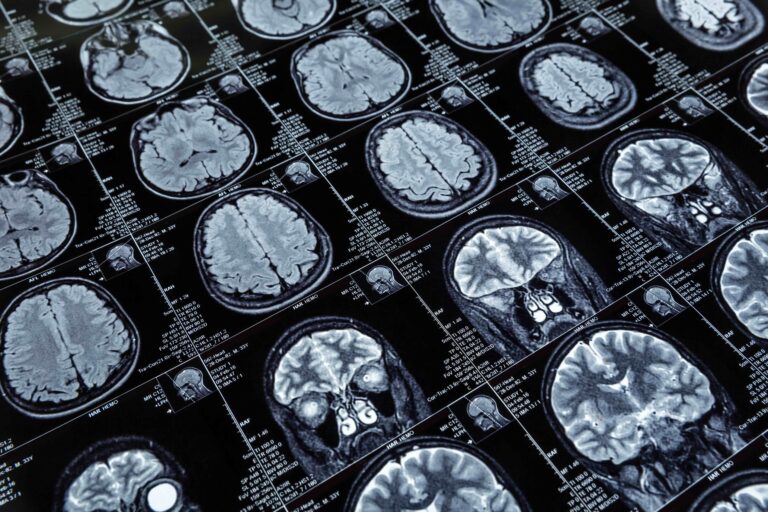 Electric Cell Signaling and Neuroplasticity